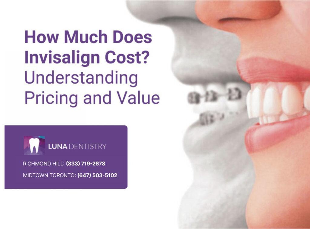 how-much-does-invisalign-cost