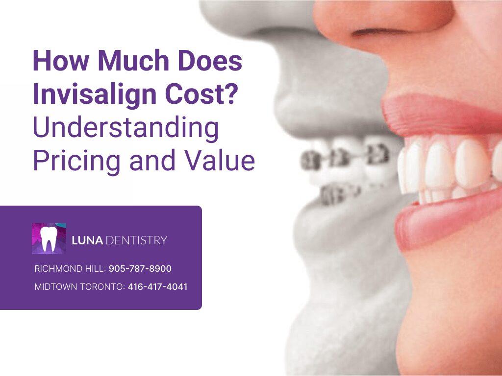 How Much Does Invisalign Cost in Midtown NYC?