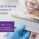 Cost-of-dental-veneers-in-Toronto