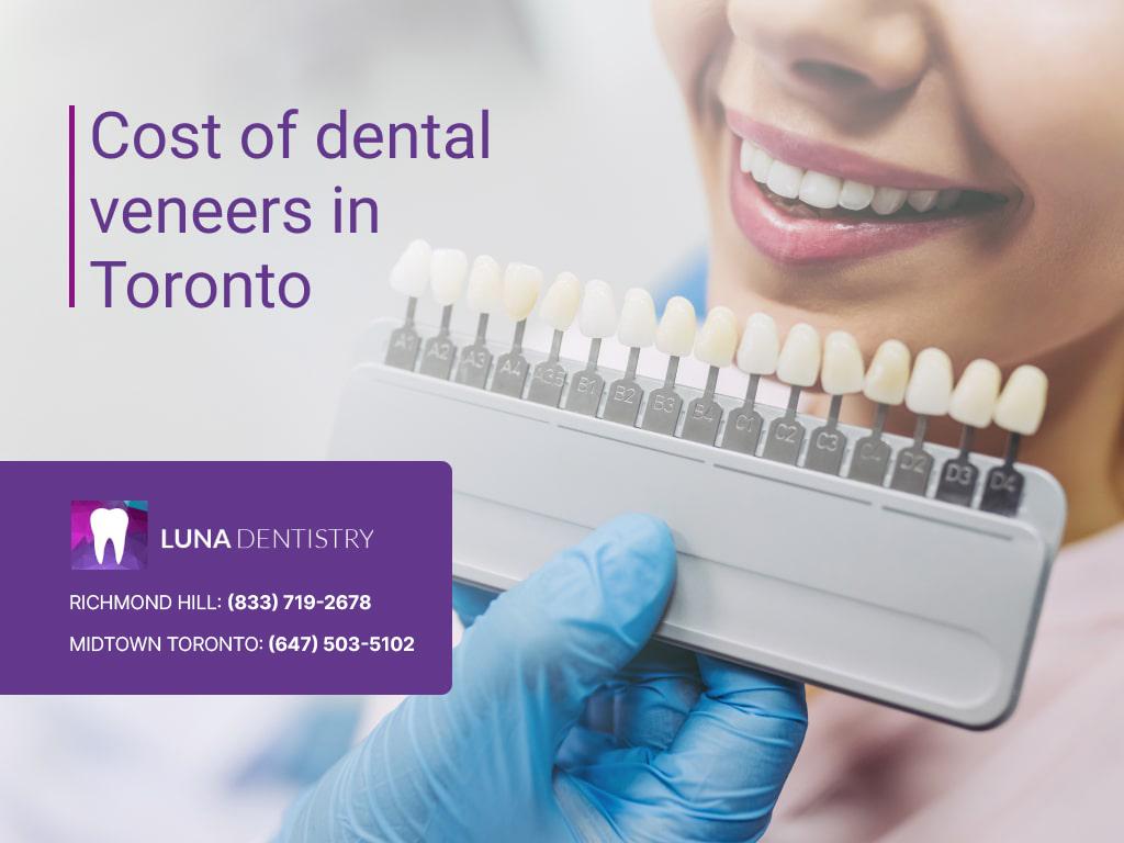 Cost-of-dental-veneers-in-Toronto