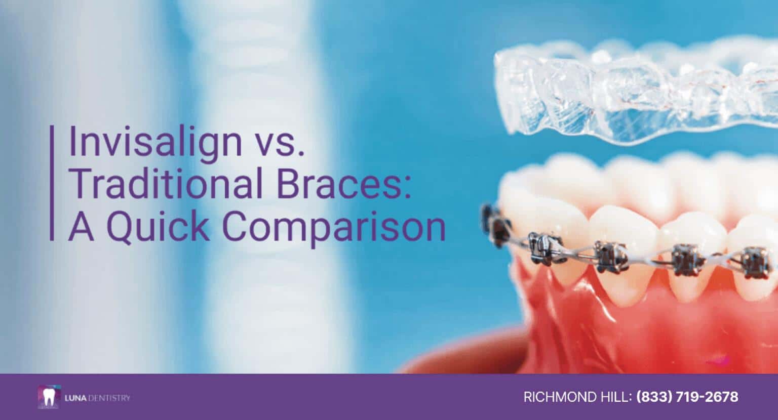 How Much Does Invisalign Cost? Understanding Pricing and Value - Luna ...