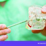 Your Body Knows Best: Identify Early Signs of a Failed Dental Bone Graft